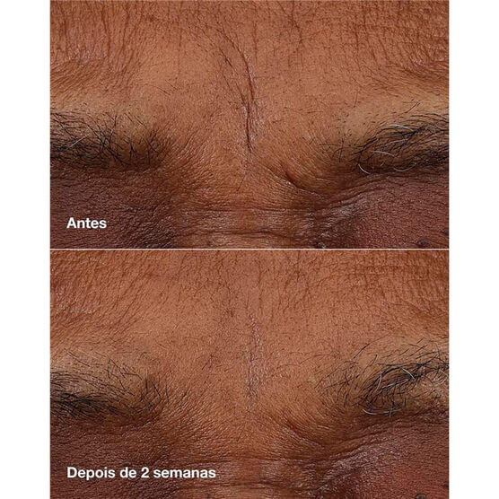 Balm Pro Idade Clinique Smart™ Retinóide